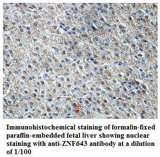 ZNF643 Antibody[39824]