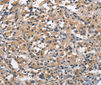 ACPT Antibody[37143]