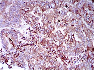 SYCP3 Mouse mAb[64290]