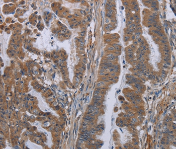 KLK8 Antibody[36577]