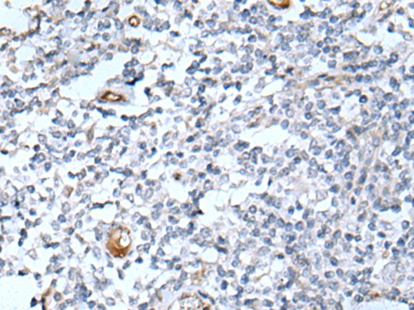 DLK2 Antibody[43718]