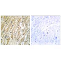 CALR Antibody[33733]