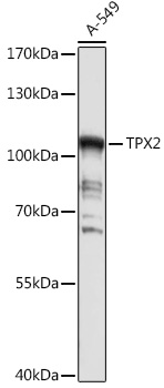 TPX2 Rabbit Polyclonal Antibod