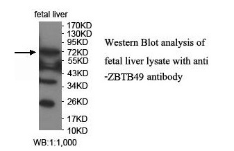 ZBTB49 Antibody[39911]