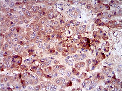 CSF1R Mouse mAb[63510]