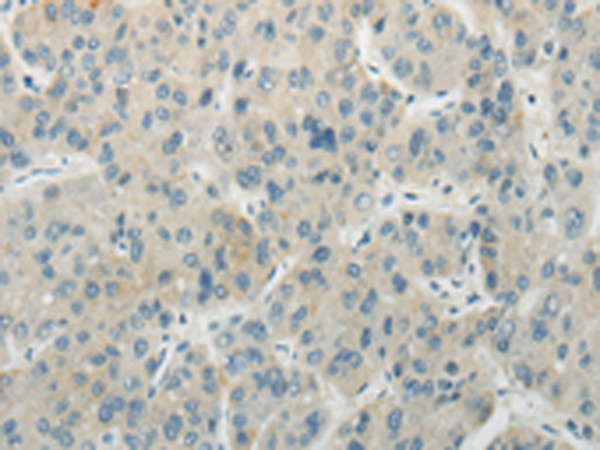 AICDA Antibody[43199]