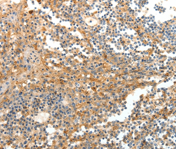 DTX3 Antibody[35712]
