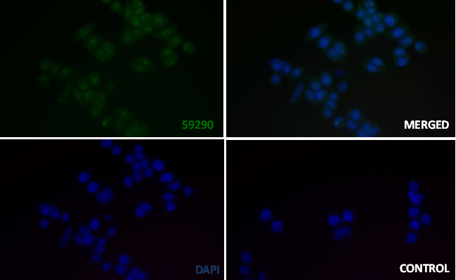 CSPG4 Rabbit mAb[59290]