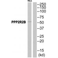 PPP2R2B Antibody[35028]