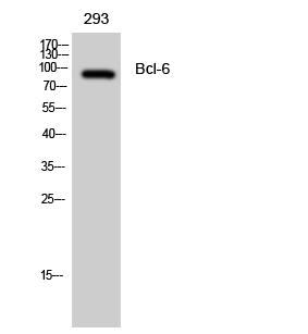 Bcl-6 Polyclonal Antibody[4064