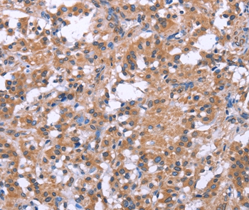 SLC52A1 Antibody[37605]