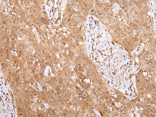 MKI67/ki67 Antibody[43095]