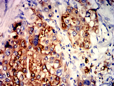 C5AR2 Mouse mAb[63180]