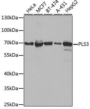 PLS3 Rabbit Polyclonal Antibod