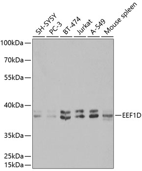 EEF1D antibody[38412]