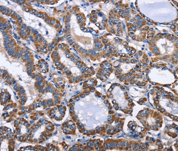 INTS10 Antibody[36159]