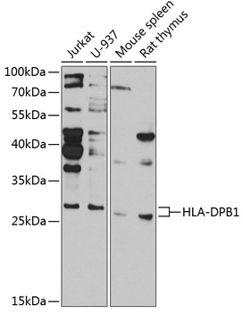 HLA-DPB1 Rabbit Polyclonal Ant