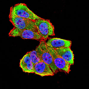 TRIB2 Mouse mAb[64357]