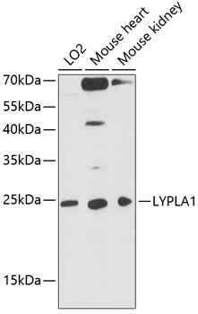 LYPLA1 Rabbit Polyclonal Antib