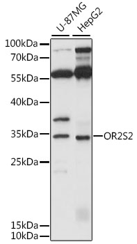 OR2S2 Rabbit Polyclonal Antibo
