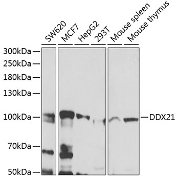 DDX21 Rabbit Polyclonal Antibo