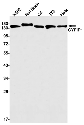 CYFIP1 Rabbit mAb[52241]