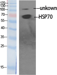 HSP70 Polyclonal Antibody[4104