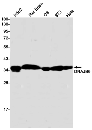 DNAJB6 Rabbit mAb[52256]