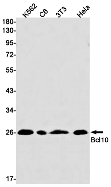 Bcl10 Rabbit mAb[52175]