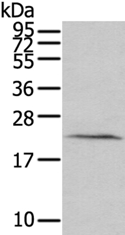 HINT3 Antibody[40182]