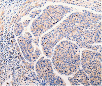 CLEC10A Antibody[35687]