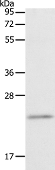 RGS2 Antibody[35906]