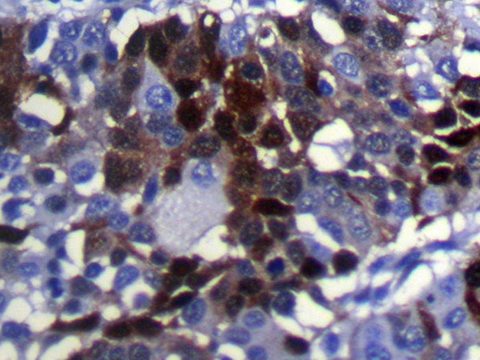 SULT2B1 Antibody[40124]