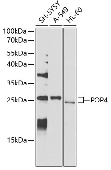 POP4 Rabbit Polyclonal Antibod