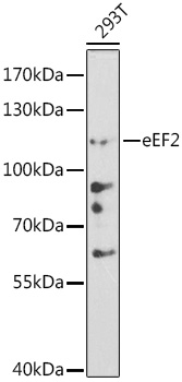 EEF2 Rabbit Polyclonal Antibod