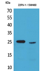 SSX Polyclonal Antibody[41594]