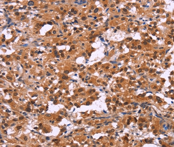 XPO1 Antibody[36228]