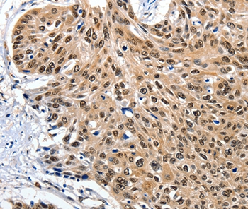 ITGAM Antibody[36962]