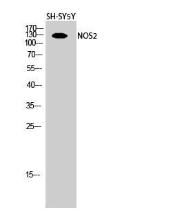 NOS2 Polyclonal Antibody[41249
