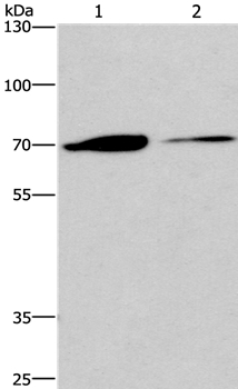 CROT Antibody[36373]