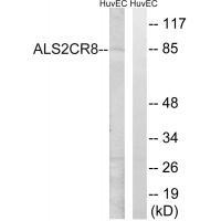 ALS2CR8 Antibody[34418]