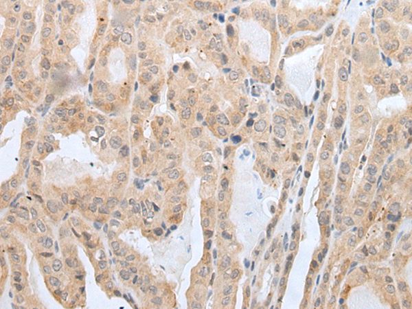 PRH2 Antibody[43931]