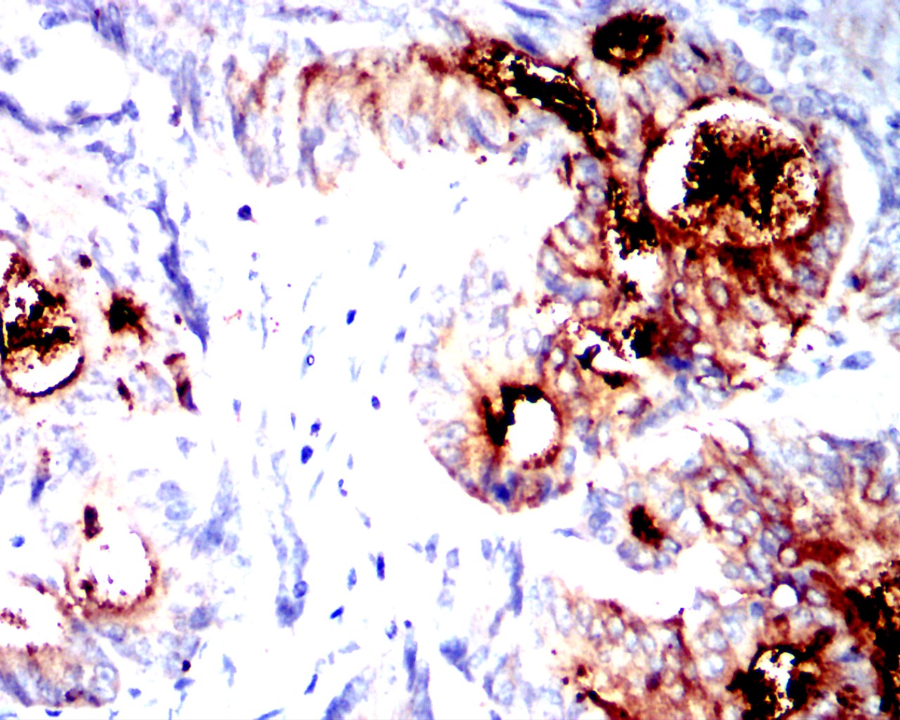 CEACAM5 Mouse mAb[63458]