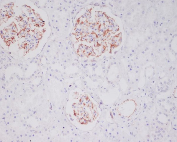 Mast Cell Tryptase Rabbit mAb[