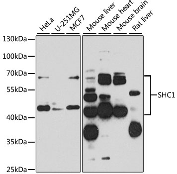 SHC1 Rabbit Polyclonal Antibod