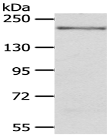 KDM6B Antibody[43401]