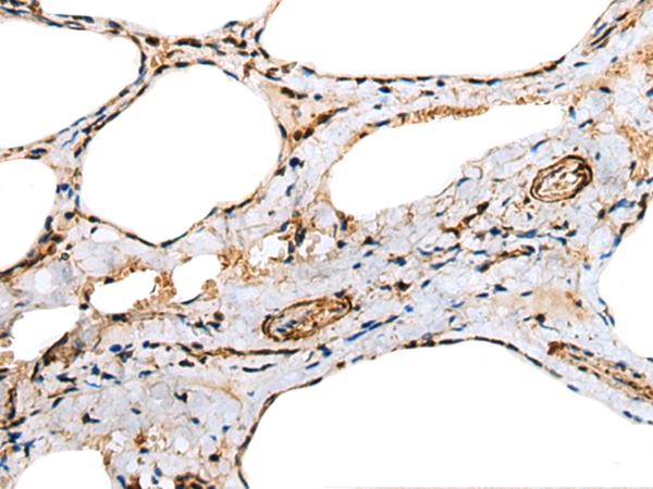 TNNC1 Antibody[43381]
