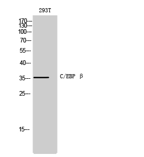 C/EBP β Polyclonal Antibody[40