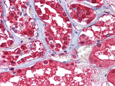 Glucose-6-phosphate isomerase 