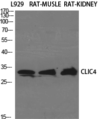 CLIC4 Polyclonal Antibody[4075